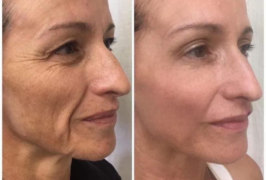Before / After